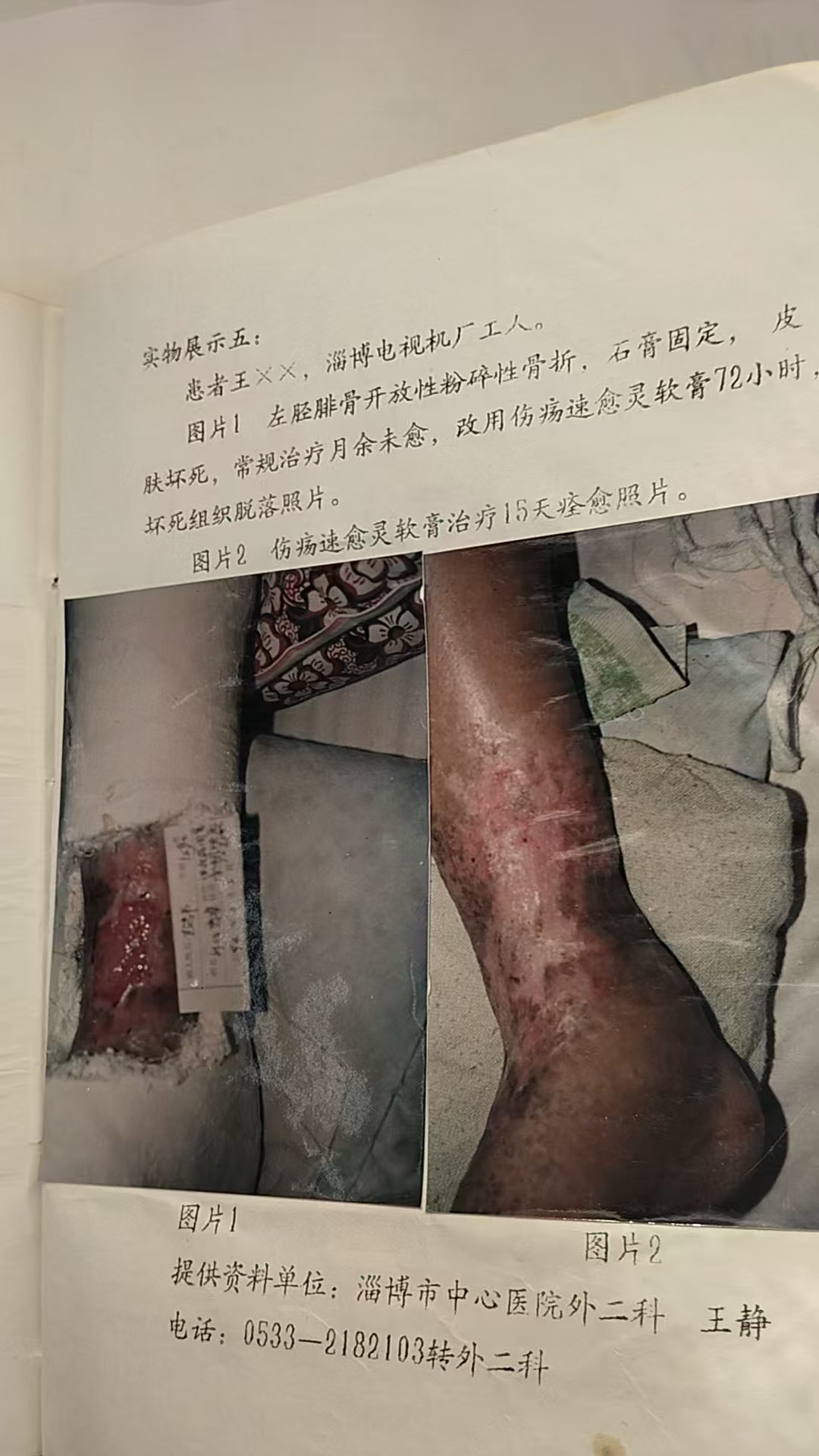 C:UsersadminDocumentsWeChat Fileswxid_klc47kjbv8n122FileStorageTemp4a94fff0ea141be5fe7d0cae138952c.jpg