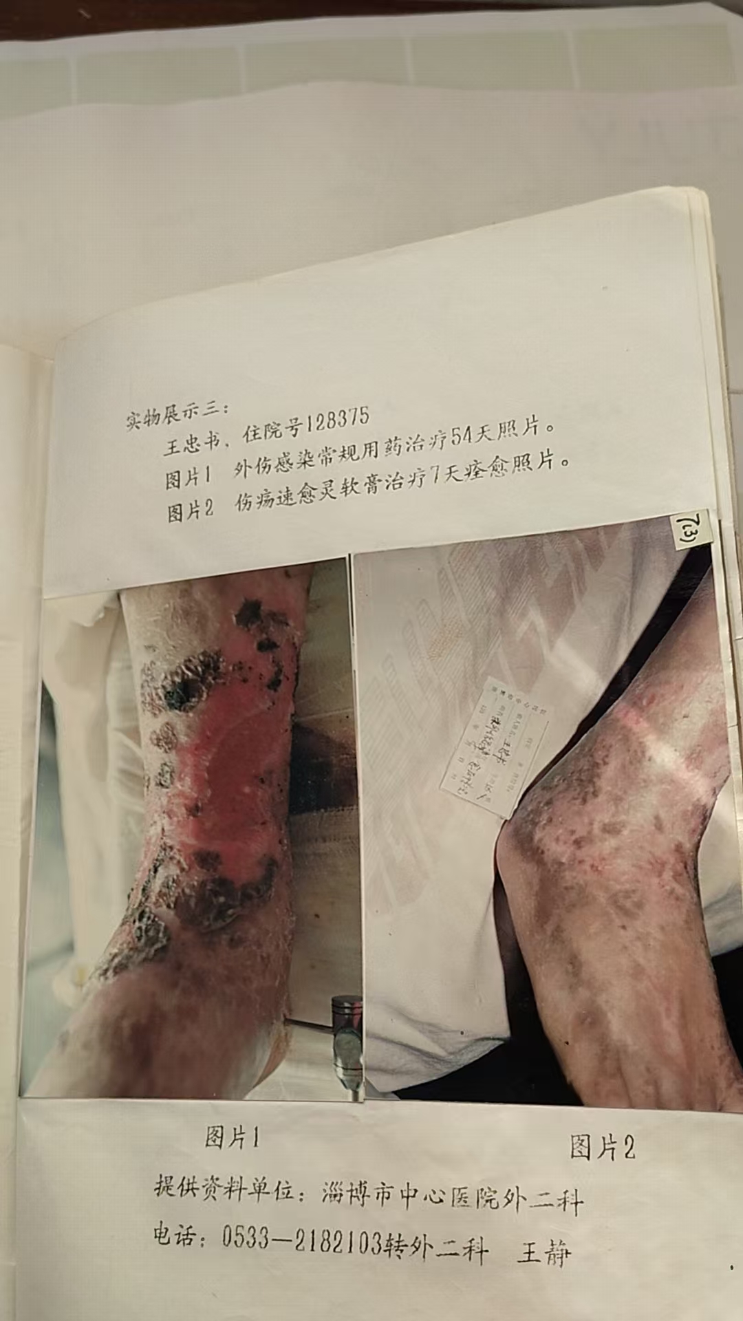 C:UsersadminDocumentsWeChat Fileswxid_klc47kjbv8n122FileStorageTempf1acd1c2fe19894f7eb08f733f2819e.jpg